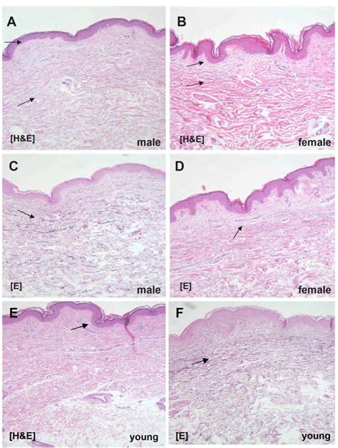 Identification of Biomarkers of Human Skin Ageing in Both 